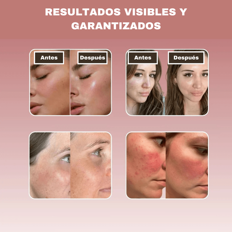 Mascarilla de Biocolágeno - Dexvon