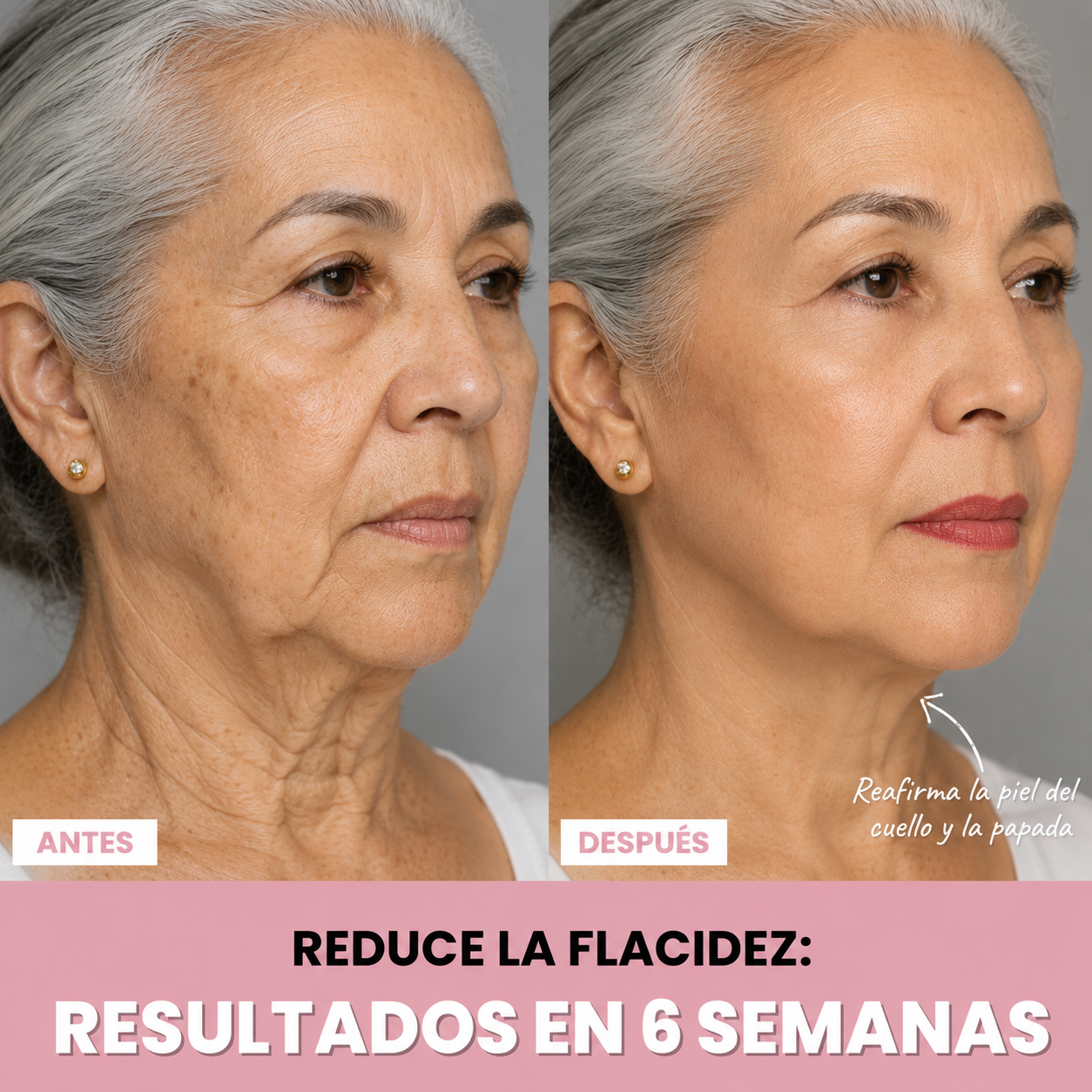 LUMIVERA™ - Escultor Facial LED 7 en 1