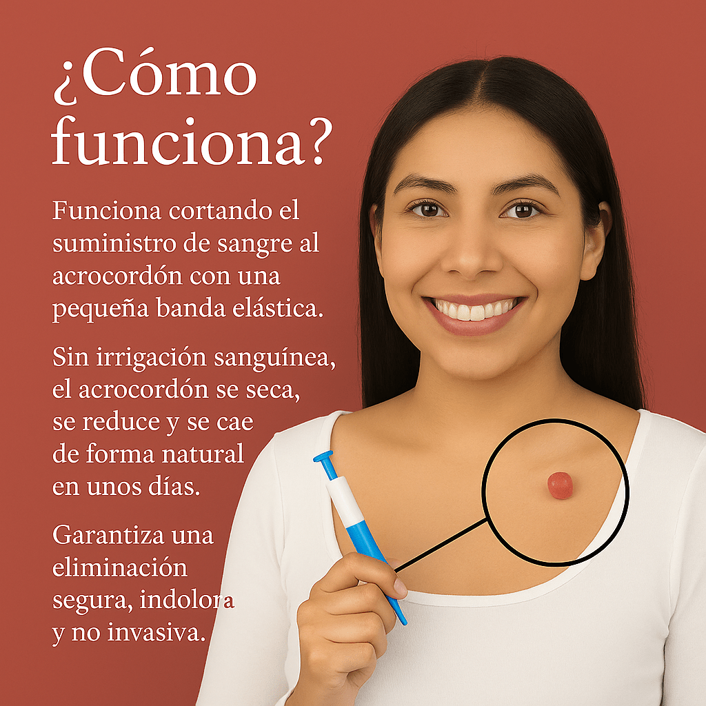 Dexvon™ – ¡Despídete de los acrocordones para siempre! - Dexvon