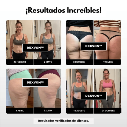 Dexvon™ - Legging que esculpe y realza al instante